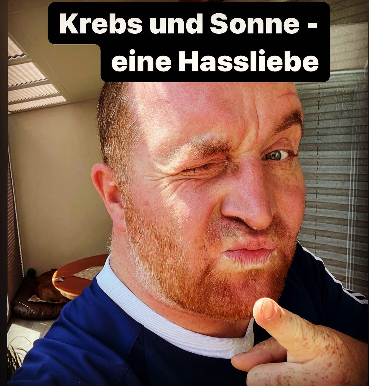 Hitze und Sonne … ein wundervoller Gedanke. Allerdings mit Chemotherapie im Body und bisschen hiervon bisschen davon … dann bin halt leider kein Supermodel und ein rothaariger Daywalker..

♥️passt auf euch auf ✌️♥️

#krebsblogger #krebsisteinarschloch #krebskämpfer #krebskrank #cancer #cancerfighter #lifestyle #lifeisgood #lifeisbeautiful #lifecoaching #lifegoals #lifeofadventure #love #selfie #healthylifestyle #healthy #gesundheit #gesundleben #krank #krankheit #lebensfreude #lebengenießen #lebensqualität #lebedeinleben #lebensmotto #fickdichkrebs #zitate#darmkrebs