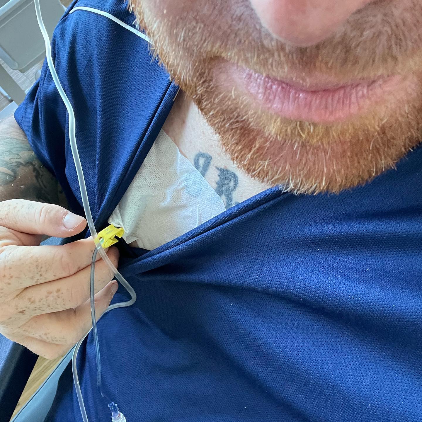 Und weiter geht’s … jede Woche… jeden Dienstag … immer das eine Ziel im Kopf … Zeit gewinnen, gesund werden noch viele viele schöne Stunden erleben dürfen. 🤞😀 

Aufgeben ist keine Option, so baue ich mir mein Leben um diese Tage bei der Chemotherapie herum. 

Ich bin gleichgültig gegenüber aller Prognosen und werde immer der Sieger bleiben. 🫶

#krebsblogger #krebsisteinarschloch #krebskämpfer #krebskrank #cancer #cancerfighter #lifestyle #lifeisgood #lifeisbeautiful #lifecoaching #lifegoals #lifeofadventure #love #selfie #healthylifestyle #healthy #gesundheit #gesundleben #krank #krankheit #lebensfreude #lebengenießen #lebensqualität #lebedeinleben #lebensmotto #fickdichkrebs #zitate#darmkrebs