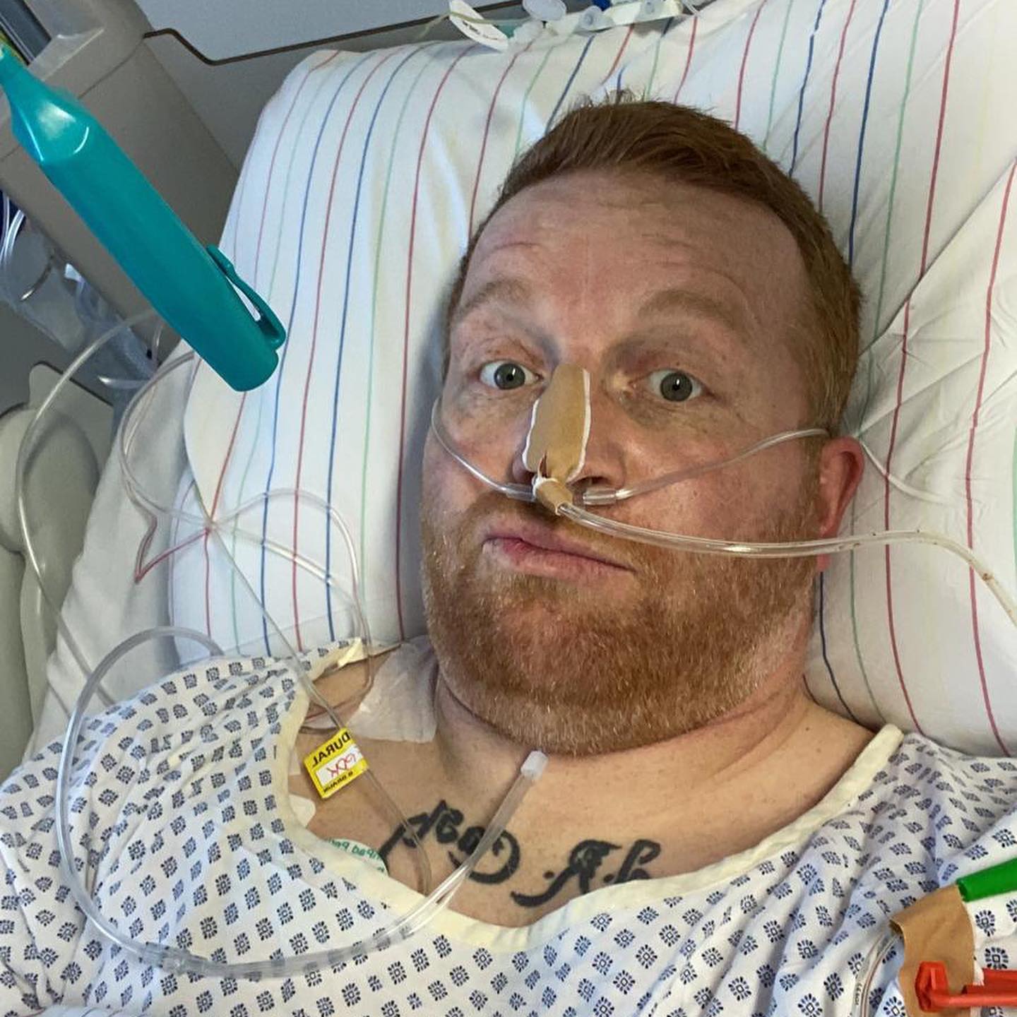 Gestern vor 2 Jahren bin ich aufgewacht. Aus dem nichts hatte ich wahnsinnige Bauchschmerzen. Ich wusste nicht mehr was zu tun ist. Ich hatte wirklich Panik bis meine Frau dann den Notarzt angerufen hat. Der Blinddarm ist geplatzt. Es war eine Notoperation. Und dann war da noch dieser Tumor. Bis dato wusste ich da ist was blödes, aber musste noch weitere quälende Tage warten ob er bösartig war. …… ja er ist bösartig und hat gestreut….

#krebsisteinarschloch #darmkrebs#krebskämpfer #krebskrank #cancer #cancerfighter #lifestyle#cancerblogger #lifeisgood #lifeisbeautiful #lifecoachin #palliativ #darmkrebs#lifeofadventure #love #selfie #healthylifestyle #healthy #gesundheit #gesundleben #krank #krankheit #lebensfreude #lebengenießen #lebensqualität #lebedeinleben #lebensmotto #fickdichkrebs #zitate 
#fckcancer