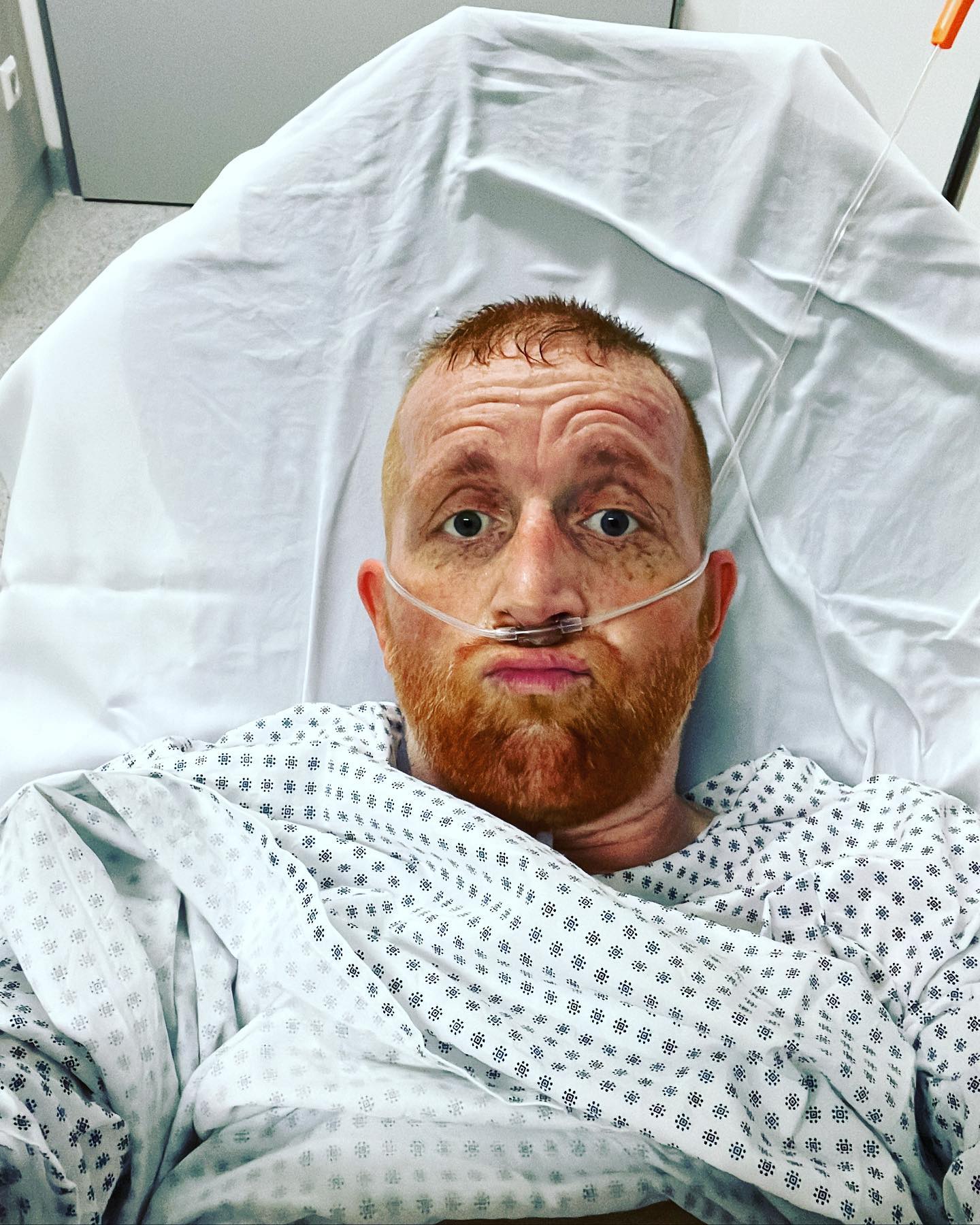 Das war vor 8 Wochen oder sowas 

Hier auf diesem Bild hatte ich abartige Schmerzen. Also keine Schmerzen die man so kennt wenn man sich mal nen Knöchel hinknallt. Ich rede von echten Schmerzen. Hier hilft kein Morphium mehr, hier half kein Dipi oder solche Dinge die man so bekommt. Man ist völlig für sich. Ich blende die Welt ein wenig aus oder male mir lustige Sachen aus. Oft muss ich auch lachen und mach morz die Scherze mir dem Notarzt oder den Mitarbeitern in der ZNA. Das hält mich manchmal davon ab nicht zu schreien. Denn es fühlt sich an als hätte man mein Achseln angezündet 🔥 es brennt es drückt der Rücken alles ziehe sich zusammen und man kann nach einer Weile nichtmehr erklären wo es weh tut. Es soll einfach aufhören. Ich spiele dann den krassen Typen. Was mit der Trage raus ? Am besten mal  Sufenta aufziehen, eine Ampulle brauch ich für den Weg, den Rest klären wir oben. Ich spüre eine warme Welle, weiß aber das hält nur 15min an dann geht’s weiter mit Schmerzen. Möchten sie sonst was ? 

Wenn ich mich komplett konzentriere, weiß ich genau was hilft und kann es erklären.
Ich schlucke meine Tränen runter und lache über den Schmerz, auch wenn’s noch so weh tut, funktioniert meistens. 

Ich bin in den Momenten oft sauer auf meinen Körper weil er weh tut. Komme mir vor wie der Held in einem Film umzingelt von lauter Schaulustigen der ein Schuss nach dem nächsten abbekommt und übermenschlich alles einfängt und darüber weinend lacht….. mir fällt jetzt kein Beispiel ein 😀😂

Eigentlich muss ich stolz sein was dieser Körper  immer wieder leistet. ✌️

Ciao Schmerz… du kannst garnix…. 

#krebsisteinarschloch #darmkrebs#krebskämpfer #krebskrank #cancer #mutmacher #cancerfighter #lifestyle#cancerblogger #lifeisgood #lifeisbeautiful #lifecoachin #palliativ #darmkrebs#lifeofadventure #dasistpalliativ #selfie #healthylifestyle #healthy #gesundheit #gesundleben #krank #krankheit #lebensfreude #darmkrebskämpfer #krebskrank  #cancerfighter #lebedeinleben #lebensmotto #fickdichkrebs #zitate 
#fckcancer