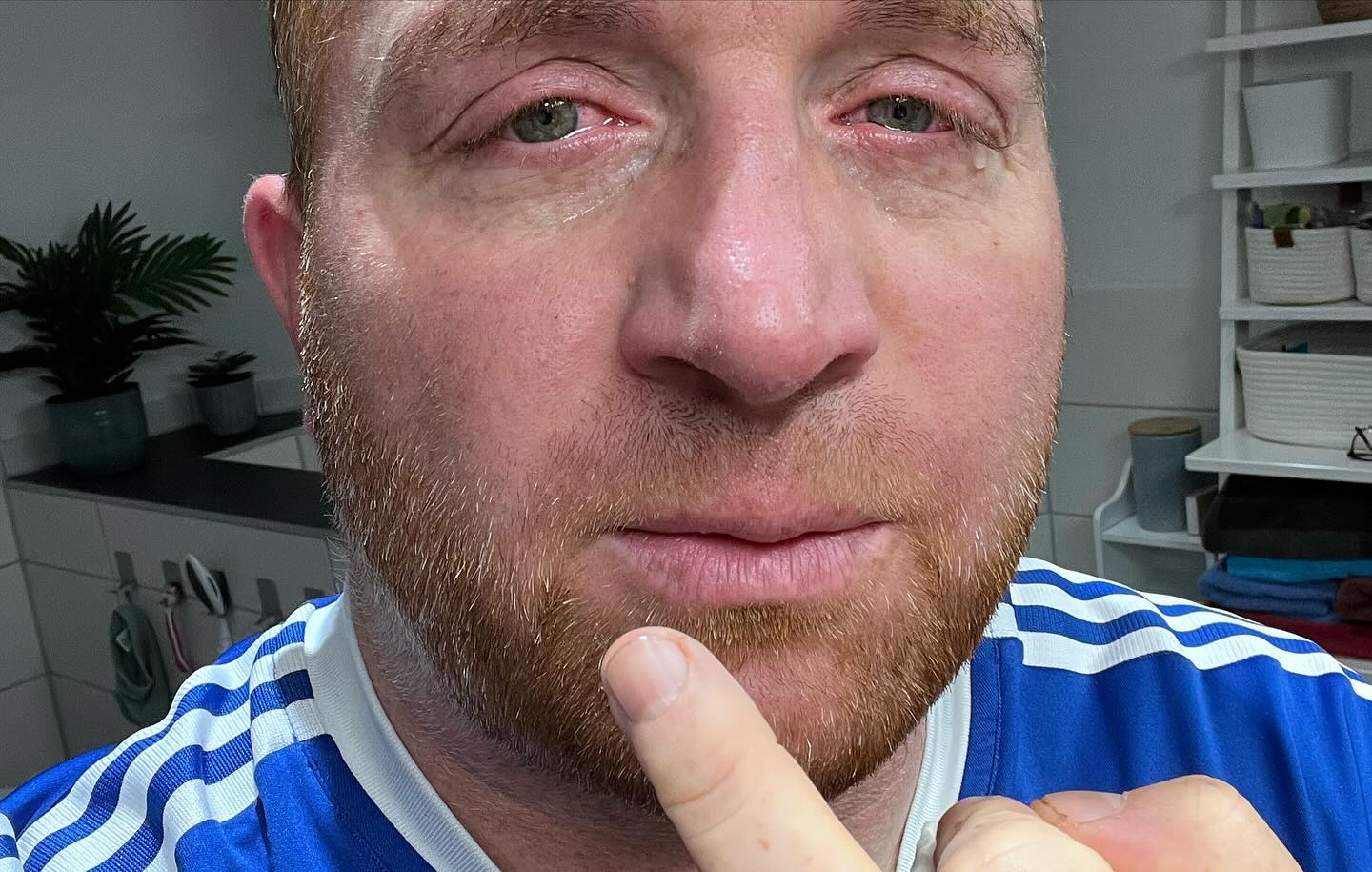 Die folgenden Bilder sind nicht nicht für  jeden geeignet. Hier ging’s mir wirklich super schlecht. Nichts desto trotz geht’s mir gut damir die Bilder zu sehen und mich erinnern. Wie stark ich gekämpft habe und wie viel Power habe. Wenn der Beastmode aktiviert ist. Wie viel ist da möglich ? Einfach alles wäre da möglich. 

Hier sieht man den eisernen Willen und jedes Feuer in meinen Augen diesem scheiss Krebs mit allem was ich habe zu begegnen. Meine ganze Kraft und meine Power bekommst du zu spüren, meine Wut, Trauer Hass und Schmerz du bekommst alles zu spüren. Bis du für immer gehst 💪🏻💪🏻💪🏻💪🏻

Ich gebe niemals auf. 💪🏻💪🏻💪🏻💪🏻

FUCK CANCER 

Diese Bilder motivieren mich weiterzumachen 💪🏻

We are CANCERBUSTERS

Wie geht’s euch bei solchen Bildern ? Motiviert euch das wenn ihr euch so sehen würdet? Oder kommen da bestimmte Gedanken die man nicht möchte ? 

#krebsisteinarschloch #darmkrebs#krebskämpfer #krebskrank #cancer #mutmacher #cancerfighter #lifestyle#cancerblogger #lifeisgood #lifeisbeautiful #lifecoachin #palliativ #darmkrebs#lifeofadventure #dasistpalliativ #selfie #healthylifestyle #healthy #gesundheit #gesundleben #krank #krankheit #lebensfreude #darmkrebskämpfer #krebskrank  #cancerfighter #lebedeinleben #lebensmotto #fickdichkrebs #zitate 
#fckcancer